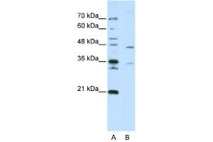 ZNF488 antibody (20R-1241) used at 0. (ZNF488 antibody  (C-Term))