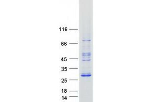 RASL10A Protein (Transcript Variant 1) (Myc-DYKDDDDK Tag)