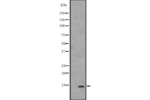 Western blot analysis of IFITM1 expression in K562,The lane on the left is treated with the antigen-specific peptide. (IFITM1 antibody  (N-Term))