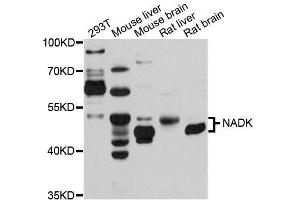 Western blot analysis of extracts of various cell lines, using NADK antibody (ABIN5996745) at 1/1000 dilution. (NADK antibody)