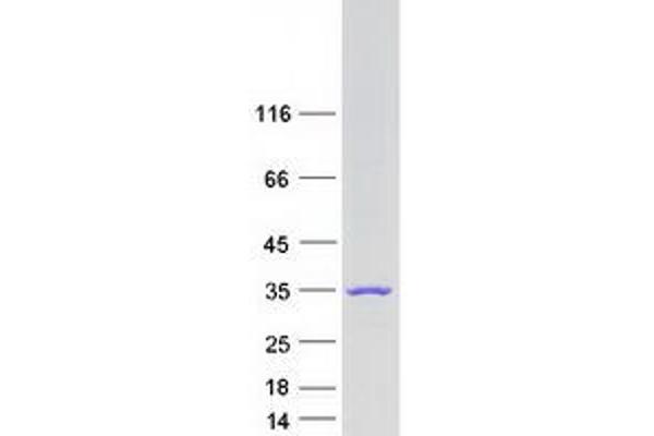 Methyltransferase Like 21D (METTL21D) (Transcript Variant 1) protein (Myc-DYKDDDDK Tag)