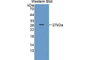 Western blot analysis of the recombinant protein. (DDC antibody  (AA 200-420))