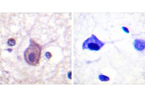 P-peptide - + (CD4 antibody  (pSer433))