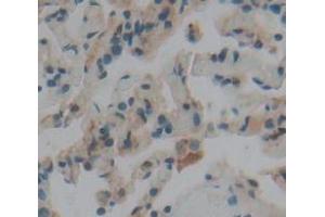 IHC-P analysis of Human Tissue, with DAB staining. (LGI3 antibody  (AA 261-548))