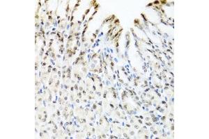 Immunohistochemistry of paraffin-embedded mouse stomach using YTHDF3 antibody. (YTHDF3 antibody)