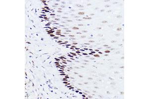 Immunohistochemistry of paraffin-embedded human esophageal using p73 Rabbit mAb (ABIN1678945, ABIN1678944, ABIN7101487 and ABIN7101488) at dilution of 1:100 (40x lens). (Tumor Protein p73 antibody)