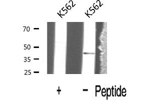 Western blot analysis of Interleukin 12B expression in K562 cells (IL12B antibody  (C-Term))