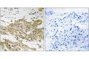 Immunohistochemistry (IHC) image for anti-Tumor Protein P53 (TP53) (pSer6) antibody (ABIN2888502) (p53 antibody  (pSer6))