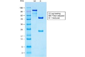 SDS-PAGE (SDS) image for anti-S100 Calcium Binding Protein B (S100B) antibody (ABIN6940560)