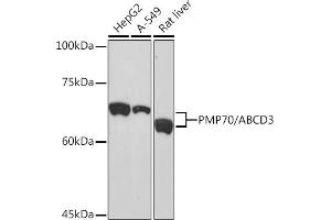 Western blot analysis of extracts of various cell lines, using PMP70/ Rabbit mAb (ABIN1683181, ABIN3018647, ABIN3018648 and ABIN7101638) at 1:1000 dilution. (CX3CL1 antibody)