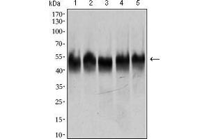 Western blot analysis using TUBB2A mouse mAb against HeLa (1), A549 (2), HEK293 (3), Jurkat (4) and PC-12 (5) cell lysate. (TUBB2A antibody  (AA 25-187))