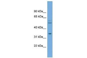 TOMM34 antibody used at 0. (TOMM34 antibody  (N-Term))