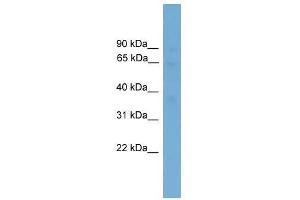 Western Blot showing SLC40A1 antibody used at a concentration of 1-2 ug/ml to detect its target protein. (SLC40A1 antibody  (Middle Region))