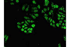 Immunofluorescent analysis of Hela cells using ABIN7169681 at dilution of 1:100 and Alexa Fluor 488-congugated AffiniPure Goat Anti-Rabbit IgG(H+L) (STAT4 antibody  (AA 569-748))