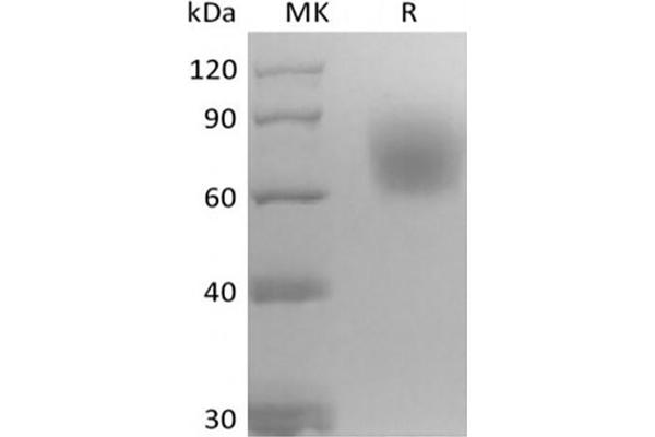 TRKB Protein (His tag)