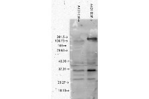 Western Blot analysis of Human A431 cell lysates showing detection of Phosphotyrosine protein using Mouse Anti-Phosphotyrosine Monoclonal Antibody, Clone G104 . (Phosphotyrosine antibody  (APC))