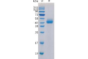 Human TG Protein, N-hFc Tag on SDS-PAGE under reducing condition. (TGFBR1 Protein (Fc Tag))