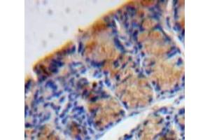 Used in DAB staining on fromalin fixed paraffin-embedded Bowels tissue (MANF antibody  (AA 28-182))