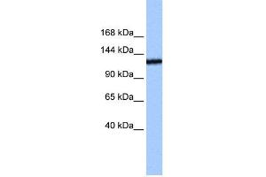 WB Suggested Anti-TEX2 Antibody Titration:  0. (TEX2 antibody  (N-Term))