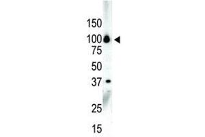 Western blot analysis of PKC nu antibody and NCI-H460 cell lysate (PRKD3 antibody  (AA 860-890))