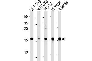 Western blot analysis in U87-MG,mouse NIH/3T3,rat PC-12 cell line and mouse testis,rat testis tissue lysates (35ug/lane). (UBE2L3 antibody  (C-Term))