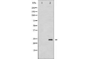 Western blot analysis of Caveolin-1 phosphorylation expression in H2O2 treated NIH-3T3 whole cell lysates,The lane on the left is treated with the antigen-specific peptide. (Caveolin-1 antibody  (pTyr14))
