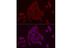 Immunofluorescence analysis of HeLa cells using PDE10A Rabbit pAb (ABIN7269297) at dilution of 1:25 (40x lens). (PDE10A antibody  (AA 23-200))