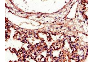 Immunohistochemistry of paraffin-embedded human lung tissue using ABIN7156533 at dilution of 1:100 (ICAM1 antibody  (AA 320-480))