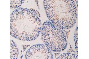 IHC-P analysis of testis tissue, with DAB staining. (LAMa4 antibody  (AA 457-630))