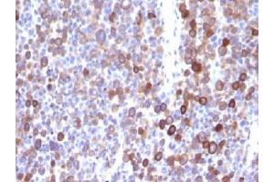 Immunohistochemistry (IHC) image for anti-Moesin (MSN) antibody (ABIN4949796)