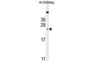 Western Blotting (WB) image for anti-2-Aminoethanethiol (Cysteamine) Dioxygenase (ADO) antibody (ABIN2996008) (ADO antibody)