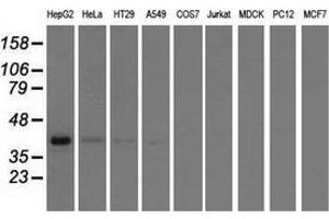 Western blot analysis of extracts (35 µg) from 9 different cell lines by using anti-HIBCH monoclonal antibody. (HIBCH antibody)