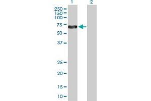 Western Blot analysis of DPYSL5 expression in transfected 293T cell line by DPYSL5 MaxPab polyclonal antibody. (DPYSL5 antibody  (AA 1-564))