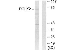 Western Blotting (WB) image for anti-Doublecortin-Like Kinase 2 (DCLK2) (N-Term) antibody (ABIN1849774) (DCLK2 antibody  (N-Term))