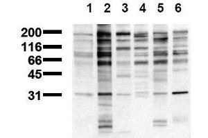 Western Blotting (WB) image for anti-Phosphotyrosine (phosphorylated) antibody (ABIN126878) (Phosphotyrosine antibody  (phosphorylated))