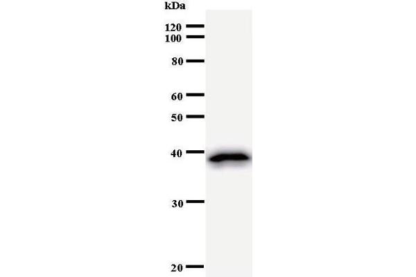 DHX29 antibody