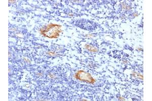 Formalin-fixed, paraffin-embedded human Tonsil stained with vWF Rabbit Recombinant Monoclonal Antibody (VWF/1859R). (Recombinant VWF antibody  (AA 1815-1939))