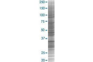 THAP10 transfected lysate. (THAP10 293T Cell Transient Overexpression Lysate(Denatured))