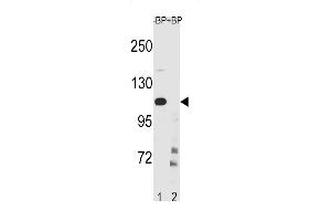 IKKB Antibody (Center ) (ABIN1881454 and ABIN2843238) western blot analysis in CEM cell line lysates (35 μg/lane). (IKBKB antibody  (AA 587-615))