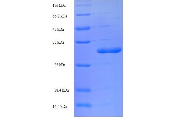 TMEM66 Protein (AA 195-339) (His-SUMO Tag)