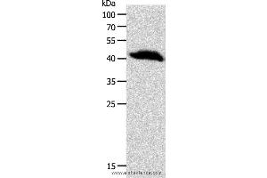 Western blot analysis of Human liver cancer tissue, using OPRL1 Polyclonal Antibody at dilution of 1:900 (OPRL1 antibody)