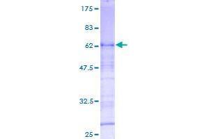 Image no. 1 for Chromosome 20 Open Reading Frame 111 (C20orf111) (AA 1-292) protein (GST tag) (ABIN1347402) (C20orf111 Protein (AA 1-292) (GST tag))