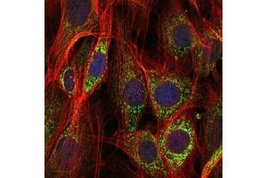 Immunofluorescence (IF) image for anti-Apoptosis-Inducing Factor, Mitochondrion-Associated, 1 (AIFM1) antibody (ABIN968950)