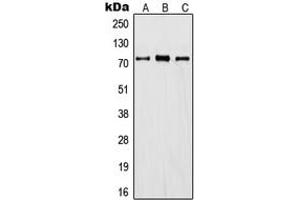 Western blot analysis of ITIH1 expression in A549 (A), mouse lung (B), rat kidney (C) whole cell lysates. (ITIH1 antibody  (Center))