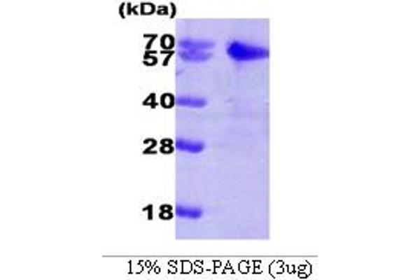 SMAD2 Protein (AA 1-467) (His tag)