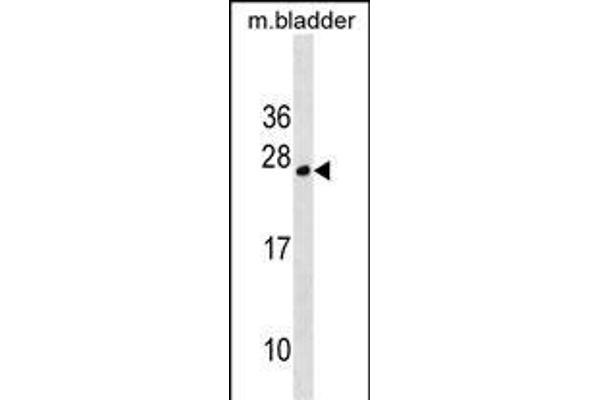 TPD52L1 anticorps  (N-Term)