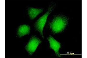 Immunofluorescence of monoclonal antibody to RANBP3 on HeLa cell. (RanBP3 antibody  (AA 298-397))