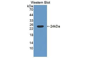 Western blot analysis of the recombinant protein. (SAT1 antibody  (AA 1-171))