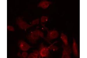 ABIN6266928 staining Hela by IF/ICC. (ZNF187 antibody  (Internal Region))
