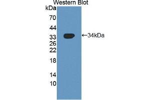 Western blot analysis of the recombinant protein. (NUAK1 antibody  (AA 421-658))